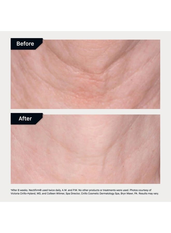 Revision Skincare نيكتيفيرم®، كريم شد الرقبة المضاد للشيخوخة لتقليل الخطوط الدقيقة والتجاعيد والجلد المتجعد، 1.7 أونصة - Image 5