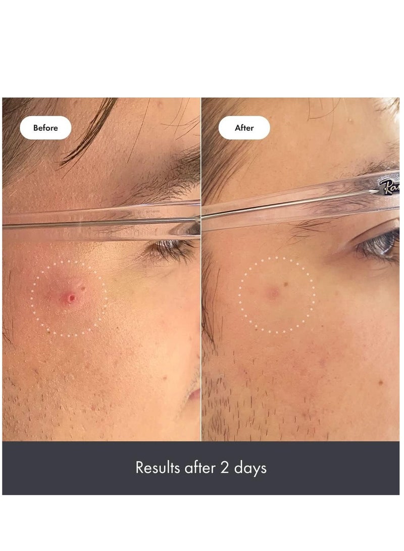 Hero Cosmetics Rescue Balm, Post Blemish Recovery Cream 15 ml - Image 4