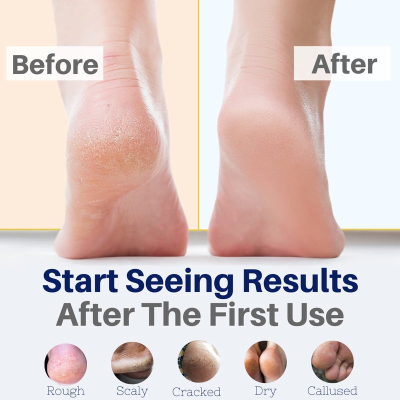 The Yellow Bird Yellow Bird Foot Cream 2 Pack Bundle - Natural Dry & Itchy Feet Repair Balm. Foot Moisturizer with Organic Ingredients and Essential Oils - Image 2