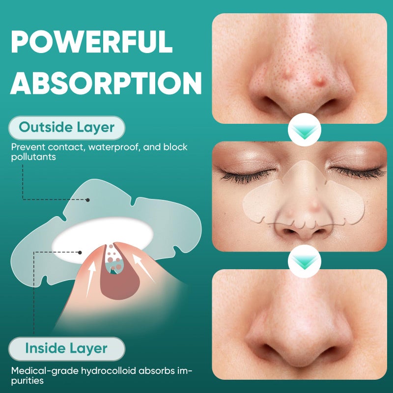 kindshine 30 Count Nose Pore Patches, Medical-Grade Hydrocolloid Pore Strips, Overnight Oil-Absorbing & Pore-Refining, Pimple Stickers to Absorb Acne Nose Gunk - Image 5