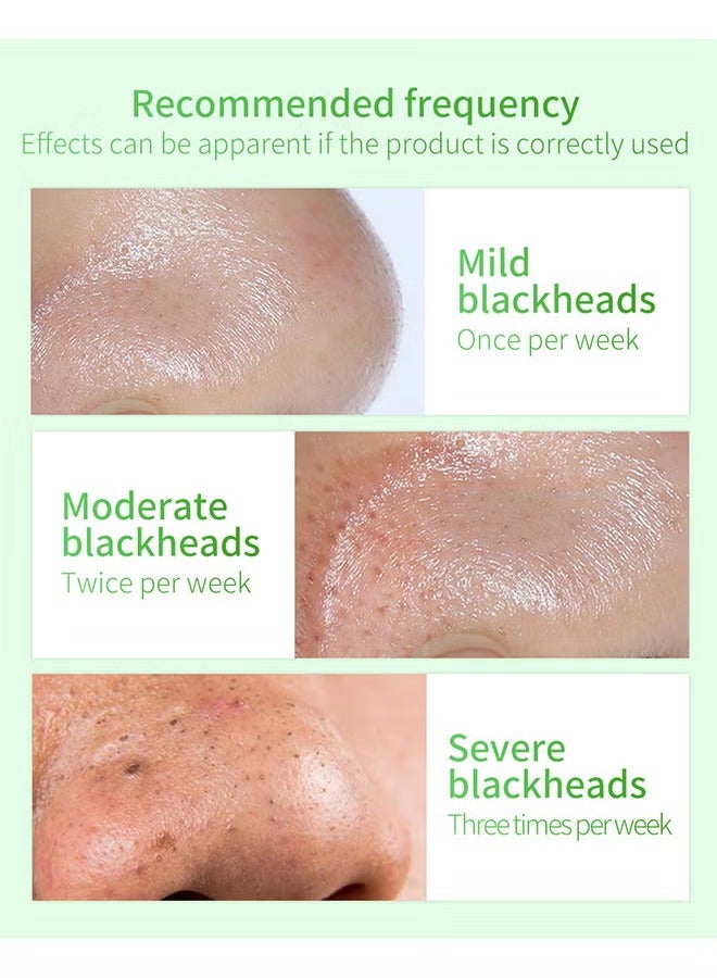 LANBENA Blackhead Remover Mask, Blackhead Remover Mask Peel Off Blackhead Mask 2 In 1 Green Tea Oil Blackhead Removal 100 Pcs Blackhead Remover Mask For Pores, Nose, Chins And Face - Image 5