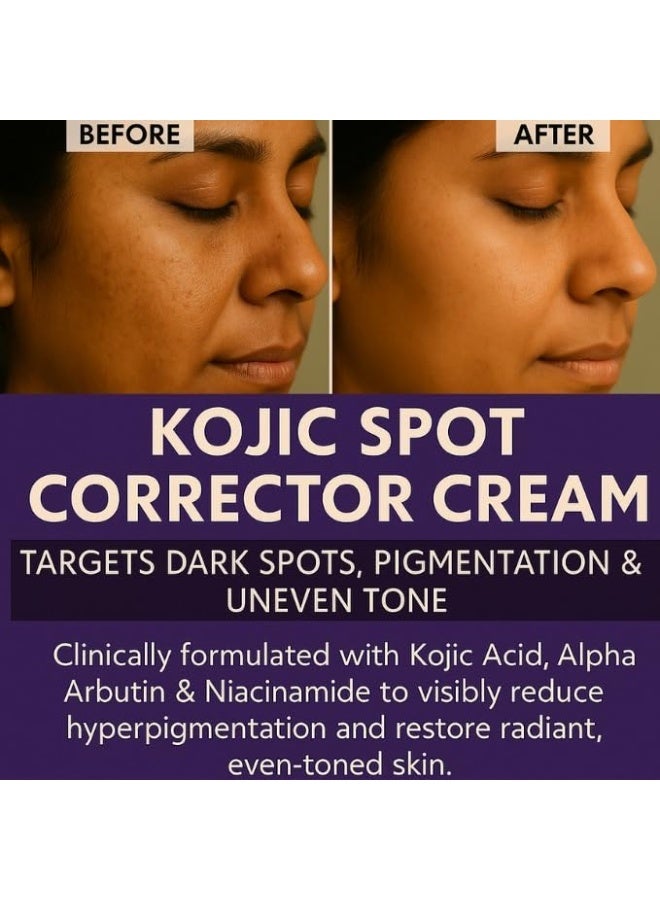 BAKE 3% Kojic Acid Spot Corrector Cream with Alpha Arbutin for Pigmentation, Dark Spots, Under Eye Circles & Even Skin Tone – 30g - Image 3