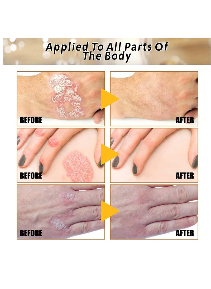 Bee Venom Repair Cream, 2 pcs Hydrating Moisturizing Cream, Women’s Anti-Blemishes All Skin Types Propolis Professional Gel - Image 4