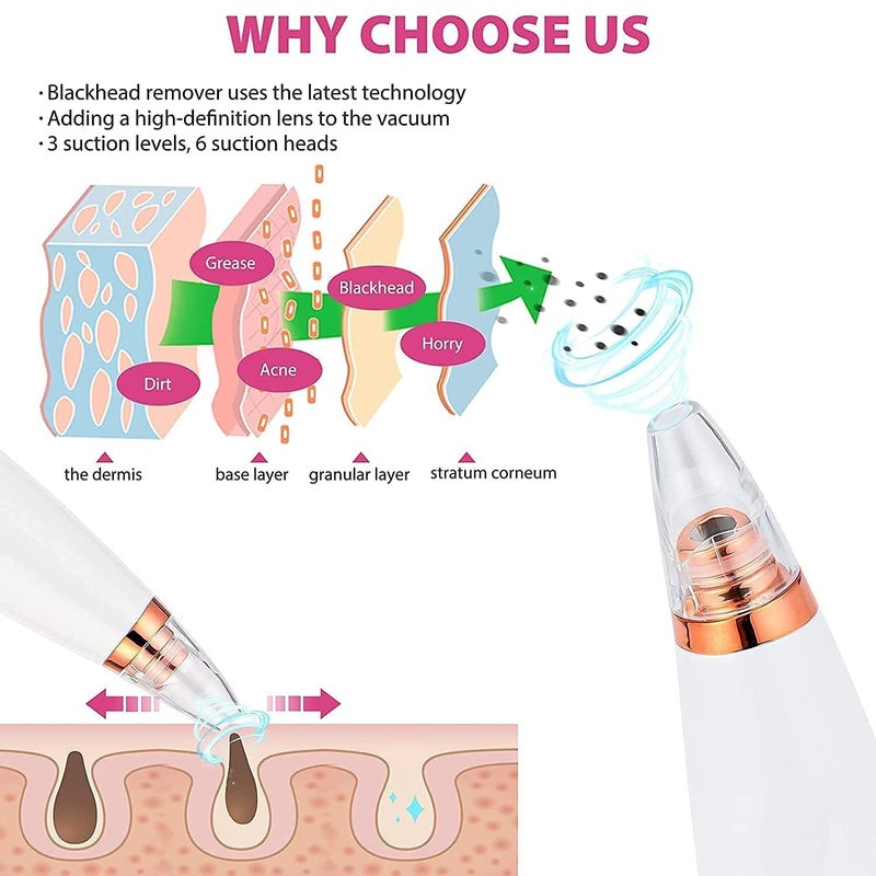 KITSSENTIAL 6 in 1 Multifunction Blackhead Remover Tools Electric Derma suction Machine USB Rechargeable Acne Pimple Pore Cleaner Vacuum tool Facial Cleanser Device for Nose Skin Care White 6 in 1 Derma Suction - Image 4