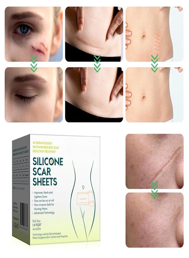 CLICKSY Scar Removal Tape Scar Removal Sheet Strips for C-Section, Acne Scars, Tummy Tuck, Keloid and Surgical Scars, Reusable Medical Grade Silicone Scar Tape, Get Scars Away Painless Reusable - Image 3