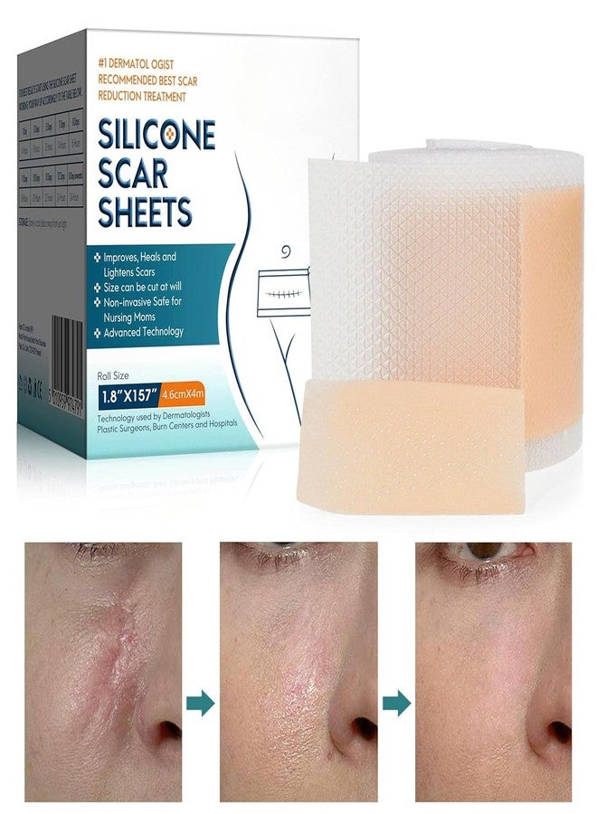 CLICKSY Scar Removal Tape Scar Removal Sheet Strips for C-Section, Acne Scars, Tummy Tuck, Keloid and Surgical Scars, Reusable Medical Grade Silicone Scar Tape, Get Scars Away Painless Reusable - Image 2