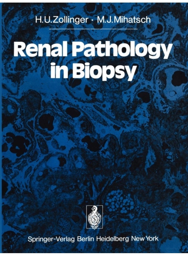 Renal Pathology in Biopsy: Light, Electron and Immunofluorescent Microscopy and Clinical Aspects