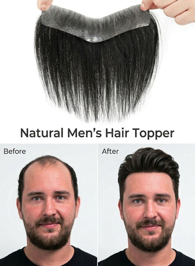 قطعة شعر للرجال مصممة خصيصًا للجبهة المتخلخلة، مصنوعة من شعر طبيعي حقيقي، غير ملحوظة على الجبهة، وتغطي منطقة تساقط الشعر بشكل مثالي، مناسبة للارتداء اليومي والتنسيق مع الباروكة. - Image 2