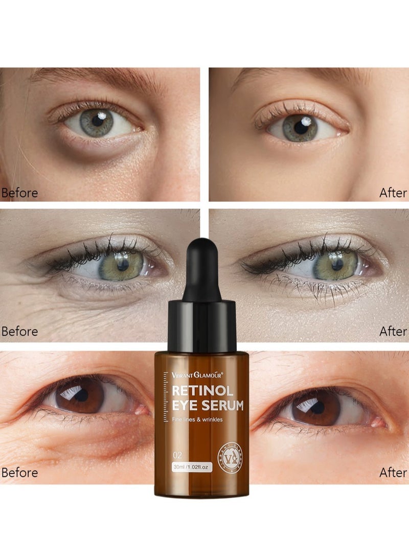 Vibrant Glamour - Anti Aging Retinol Eye Serum 30ml Rapid Wrinkle Repair Anti Wrinkle Skin Remove Age Dark Circles - Image 1