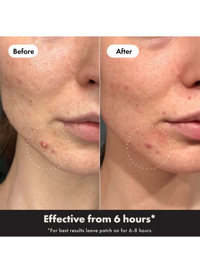 Mighty Patch Day + Night 24 Pieces - Image 4