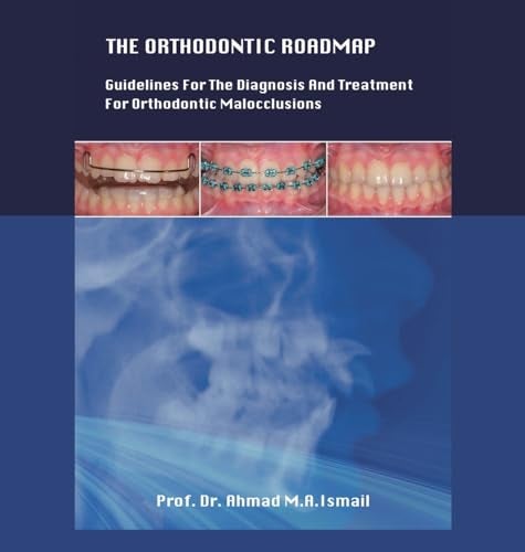The Orthodontic Roadmap Guidelines For The Diagnosis And Treatment Of Orthodontic Malocclusions 