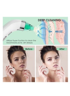 Excefore Blackhead Remover Vacuum, Electric Pore Blackhead Extractor, Facial Pore Cleaner-5 Suction Power, Pore Cleaner, USB Rechargeable Pimple Sucker, Vacuum Blackhead Remover Tools and 5 Probes  - Image 4