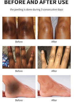 MOOYAM Peeling Oil for Dark Skin, Green Extra Strength Exfoliating Body Peeling Oil, Chemical Peel Solution for Hands and Feet, Effective Exfoliation for Smooth and Radiant Skin  - Image 5