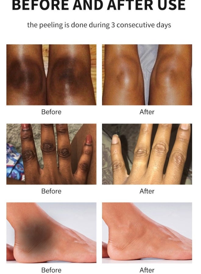 MOOYAM Peeling Oil for Dark Skin, Green Extra Strength Exfoliating Body Peeling Oil, Chemical Peel Solution for Hands and Feet, Effective Exfoliation for Smooth and Radiant Skin - Image 5