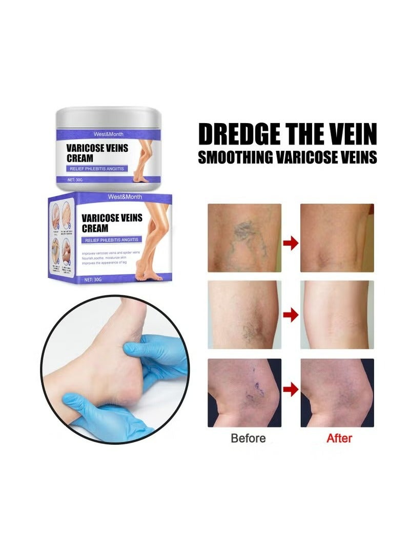 WEST MONTH Varicose Veins Cream，Soothing Leg Cream, Varicose and Spider Veins Treatment Cream, Improve Blood Circulation, Fast Relieve Swelling Pain 30g - Image 5