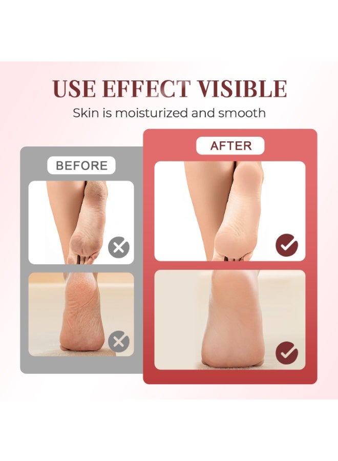 Bukela Electric Foot Callus Remover, Upgrade 2 in 1 Electric Foot File with Grinder Heads, Adjustable Foot Sander Pedicure Tools for Feet Dead Skin with Display and Base (White) - Image 4