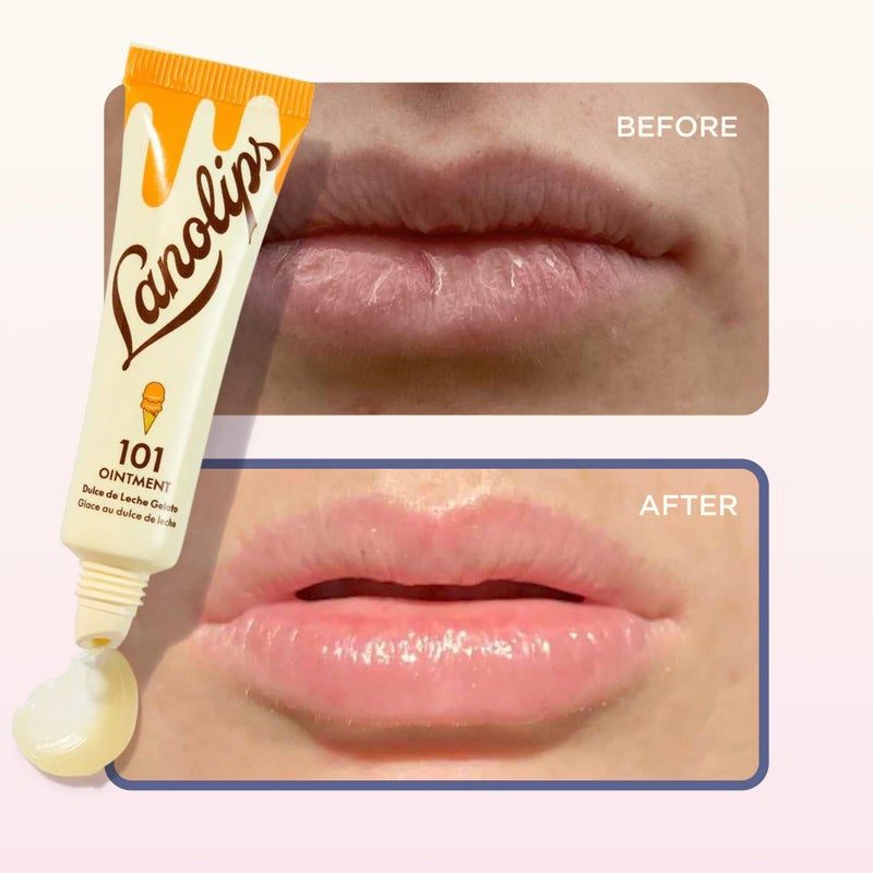 Lanolips Lanolin 101 Multipurpose Ointment - Lanolin Lip Balm & Healing Ointment for Skin Barrier Repair - Moisturizer for Dry Lips, Cuticles & Elbows - No Petroleum Formula - Dulce de Leche (0.35 oz) - Image 5