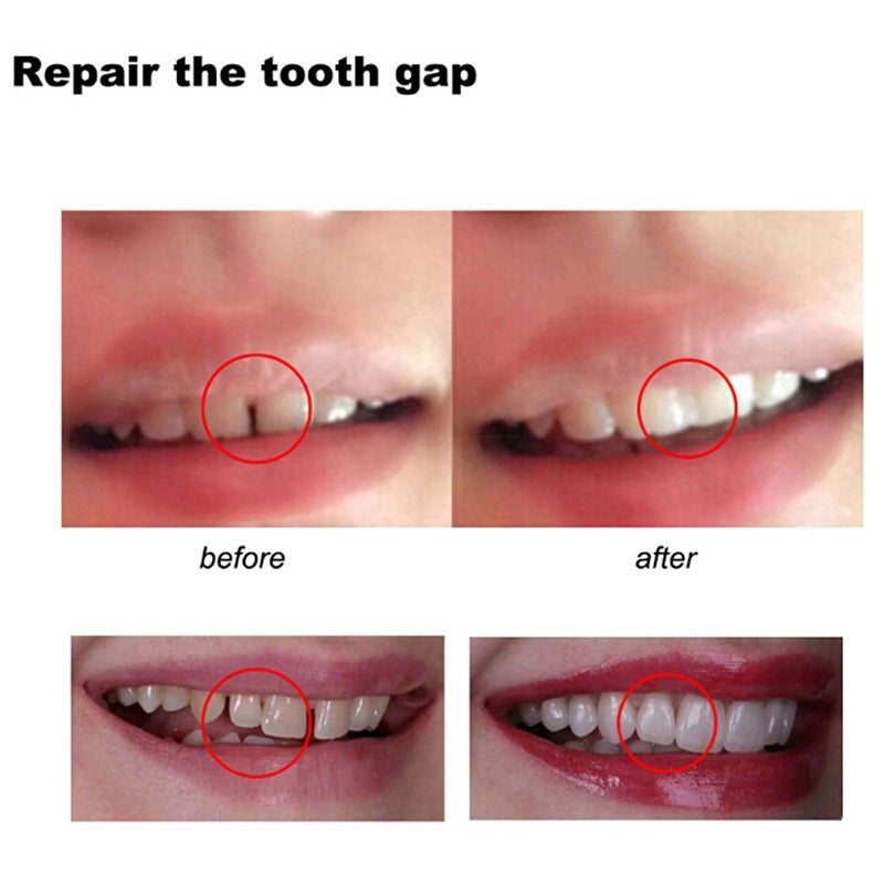 Factory Solid Gum Film And Television Makeup Denture Modification Temporary Filling Gum Tooth Cavity Tooth Gap Filling Gum - Image 4