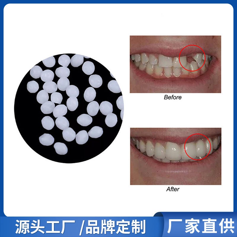 Factory Solid Gum Film And Television Makeup Denture Modification Temporary Filling Gum Tooth Cavity Tooth Gap Filling Gum - Image 2