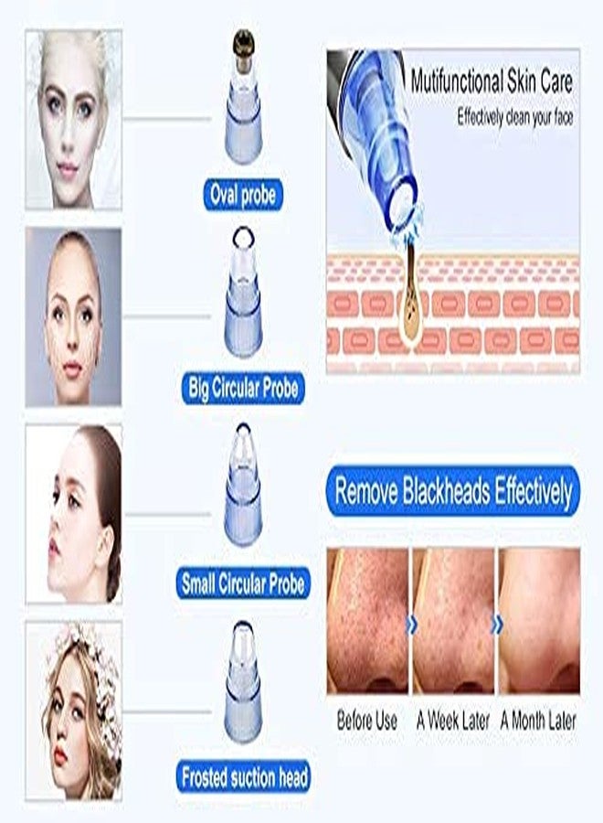 ShipFayda 4-in-1 Blackhead Remover - Multi-Function Pore Cleaner, Acne Extractor & Vacuum Suction Tool for Men & Women (Multicolor) - Image 5