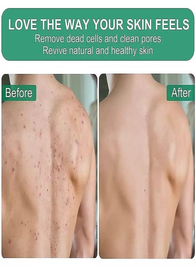 Ncry قفازات تقشير Ncry لإزالة الجلد الميت - قفاز حمام مغربي - أحدث إسفنجة استحمام للجسم - تزيل الجلد الميت بشكل واضح، رائعة لإزالة السمرة (قطعة واحدة سوداء) - Image 3