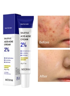 MOOYAM Salicylic Acne Cream- Lighten Acne Marks Remove Acne Shrink Pores Plant Essence - Fast Acne Removal in 12 Hours to See Results 20g  - Image 1
