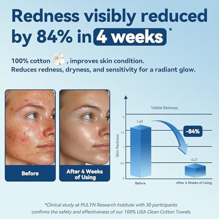 Winner Soft Face Towels, Upgraded Thicker 100% Cotton Dry Wipes, Unscented and Gentle on Sensitive Skin, Disposable Makeup Remover and Facial Towelettes (240 Count, Pack of 3) - Image 2