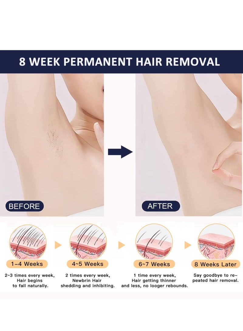 MLAY Newest T14 Laser Painless Fast Hair Removal 3℃ Cold Compress/5-Levels/500000 Pulses - Image 5