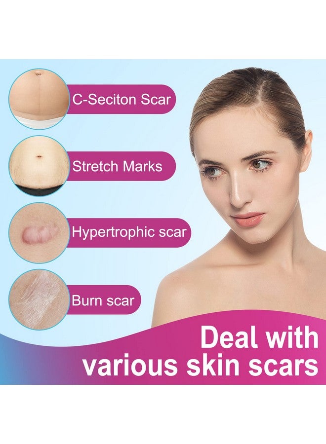 one1x Silicone Scar Sheets,Silicone Scar Tape Roll,Medical Grade Silicone Tape For Scar Removal,Reusable Professional Scar Treatment Patch For C-Section,Keloids,Surgical,Acne (Roll Size 1.6''X75''-1.9M)