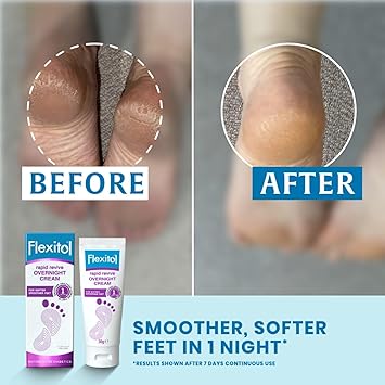 Flexitol Rapid Revive Overnight Foot Cream 30 Percent Urea for Extremely Dry Hard Rough Skin on Feet Results in 1 Night Clinically Proven Foot Care High Urea Suitable for Diabetics 50g - Image 2