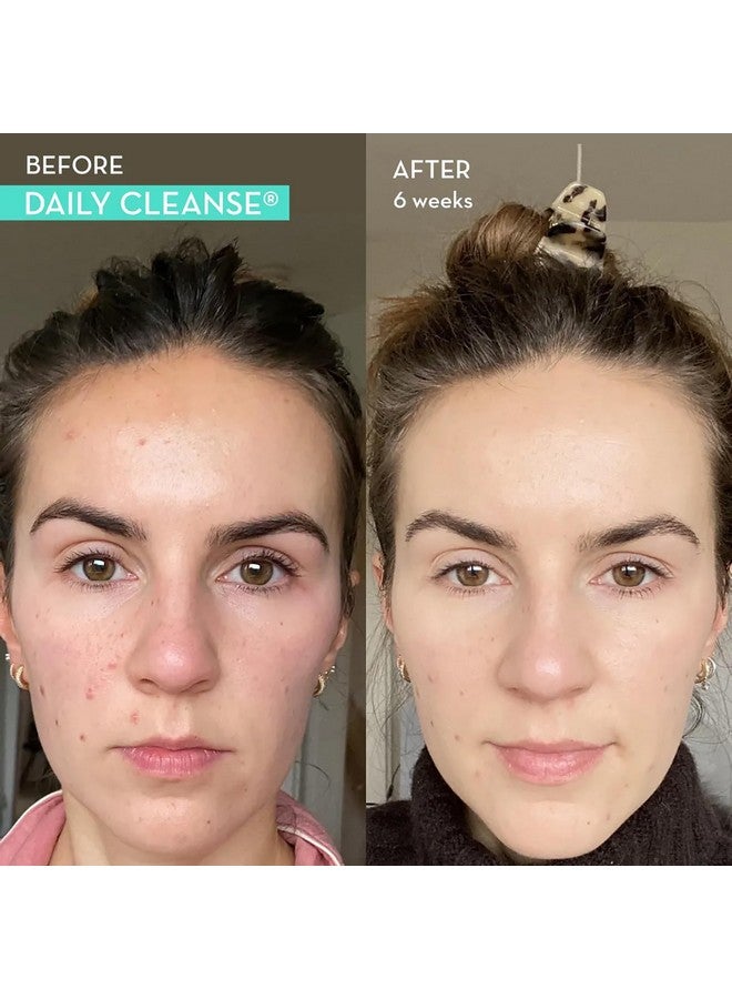 HUM Daily Cleanse Acne Supplement - Gut Cleanse Detox for Clear Skin with Organic Algae, Detoxifying Herbs, Zinc & Spirulina | Clear Skin Supplement (60 Capsules) - Image 3