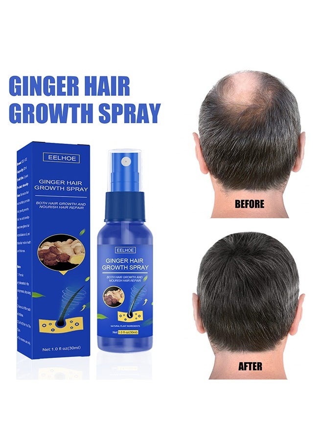 EELHOE Ginger Hair Growth Spray,Ginger Herb Formula Stop Hair Loss Hair Regrowth Treatments Grow Thicker Longer Hair Accelerate Hair Growth for Men and Women 30ml  - Image 1