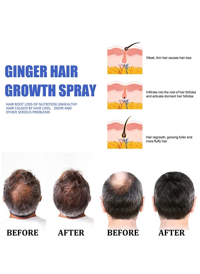 EELHOE Ginger Hair Growth Spray,Ginger Herb Formula Stop Hair Loss Hair Regrowth Treatments Grow Thicker Longer Hair Accelerate Hair Growth for Men and Women 30ml  - Image 3