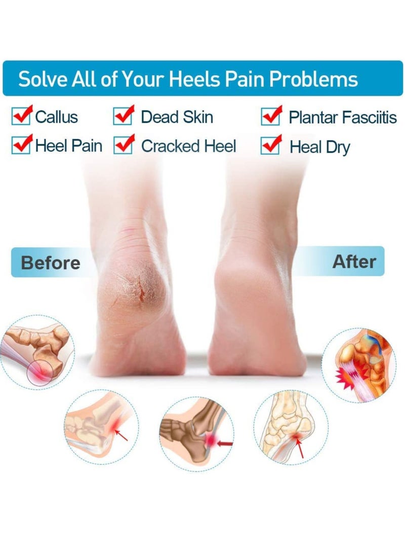 VIUAUAX 8 قطع من وسادات التهاب اللفافة الأخمصية، وسادة كعب هلامية، واقيات الكعب من السيليكون، واقيات الكعب وأكواب الكعب لإصلاح الكعب الجاف المتشقق وتقليل آلام التهاب اللفافة الأخمصية، وتقرح الكعب - Image 5