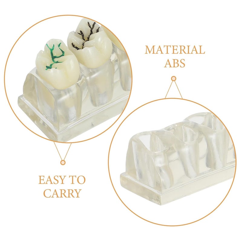 KSA market popular practical build Oral Caries Tooth Model - 4 Times Oral Study Model for Health Education Teachers and Clinical Demonstration Purposes - Detachable Decayed Teeth Prop New residential zone delivery Dust proof Neat shape Reliable local delivery service Main road full logistics cover Medium weight Daily wear upgraded resistant material Globally selected raw material Globally engineered build Global trendy simple build Multi-style matching design Global mainstream design picks Light precision processed material Organized shipment arrange Popular practical build UV resistant Efficiency boosted construction Domestic distribution ready Shop & home all-space compatible Experience optimized build KSA standard compatible design Bulk storage easy optimized build Fast intercity distribution Air & land transit compatible - Image 3