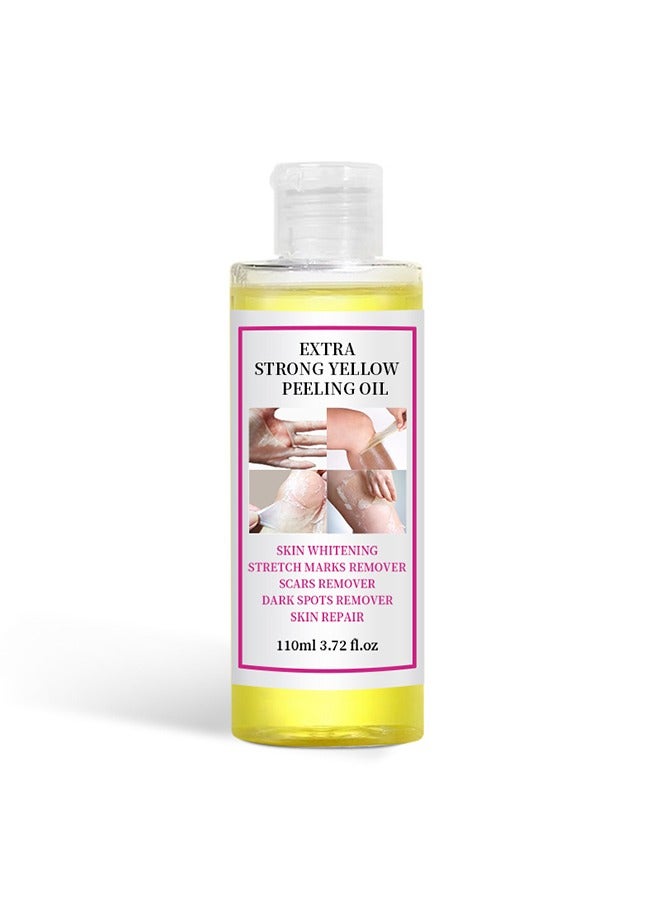 EELHOE Yellow Peeling Oil 110ml Super Strength Dead Skin Remover Skin Moisturizing Hydrating Butter Peeling Remove Dead Skin and Calluses on Feet and Hand Dark Spot Peeling Oil - Image 3