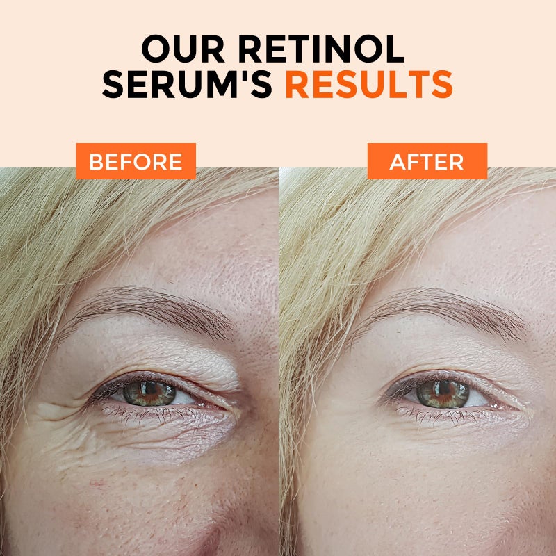 +1HEROLABS Retinol Serum for Face 2.5%, B5 Resurfacing Retinol Serum with Vitamin C, Vitamin E, Hyaluronic Acid, Niacinamide, Peptide for Anti-Aging, Wrinkle Smoothing, Dark Spot Corrector, Brighten Dullness - Image 5