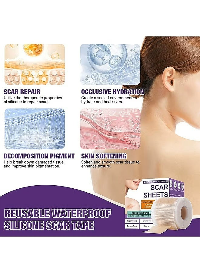 Silicone Scar Tape, Silicone Scar Removal Sheets For Surgical, Reduces Keloid Visibility For Surgical C-Section Tummy Tuck Keloid Scars - Image 3