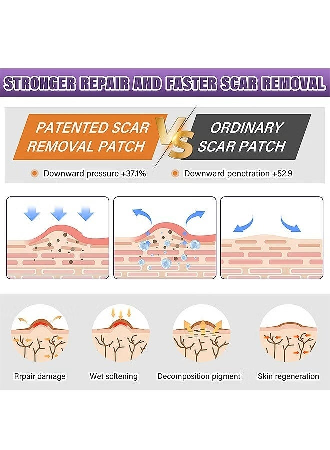 Silicone Scar Tape, Silicone Scar Removal Sheets For Surgical, Reduces Keloid Visibility For Surgical C-Section Tummy Tuck Keloid Scars - Image 4