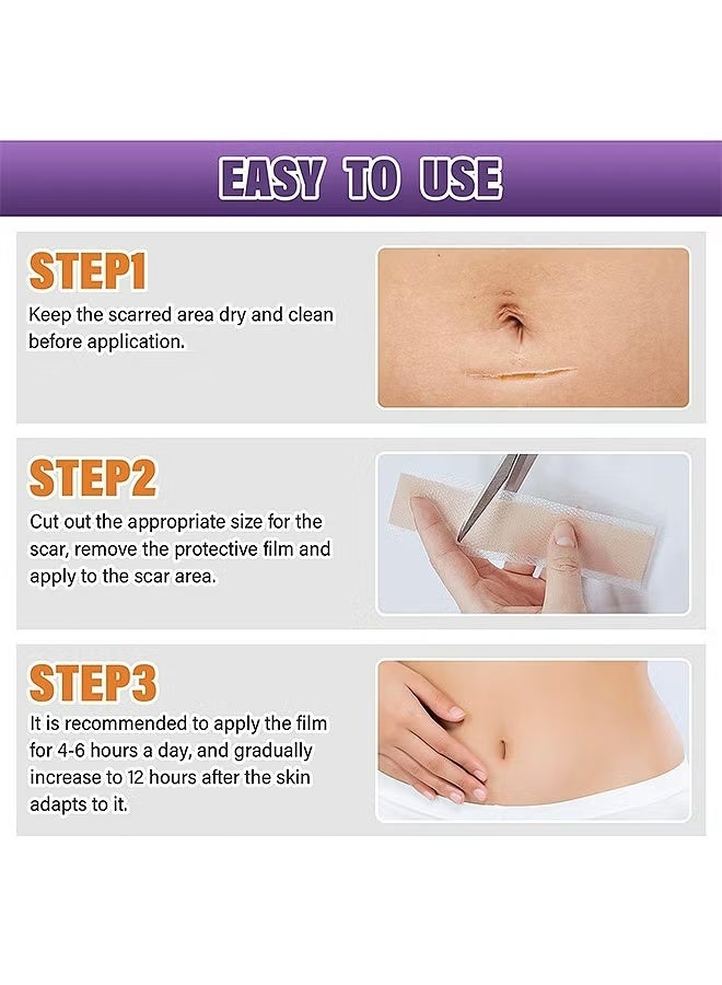 Silicone Scar Tape, Silicone Scar Removal Sheets For Surgical, Reduces Keloid Visibility For Surgical C-Section Tummy Tuck Keloid Scars - Image 5