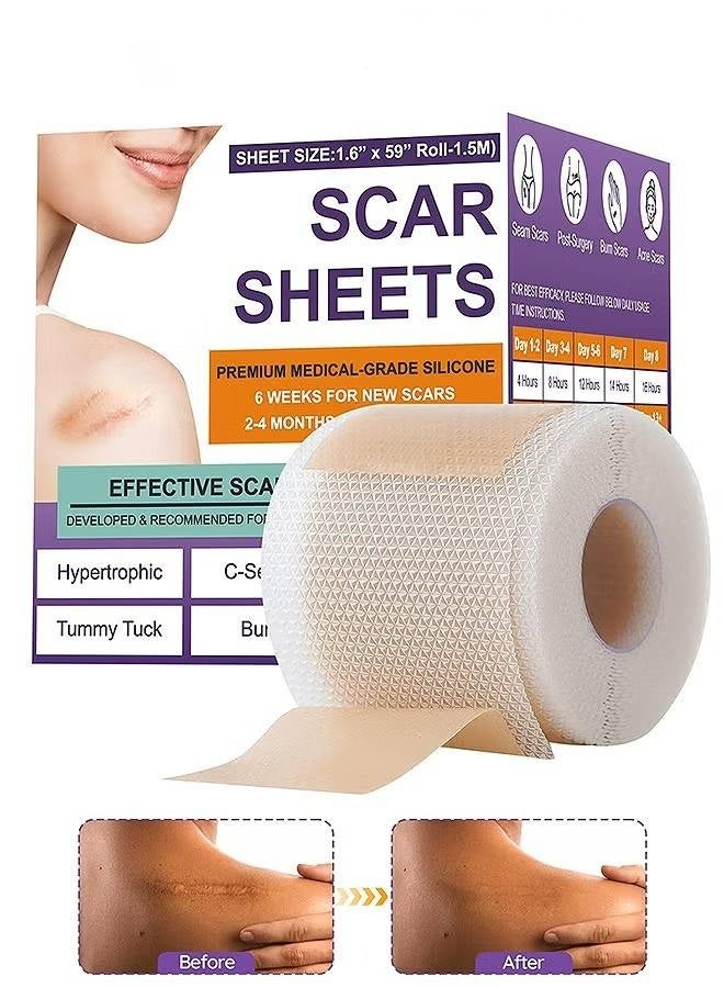 Silicone Scar Tape, Silicone Scar Removal Sheets For Surgical, Reduces Keloid Visibility For Surgical C-Section Tummy Tuck Keloid Scars - Image 1