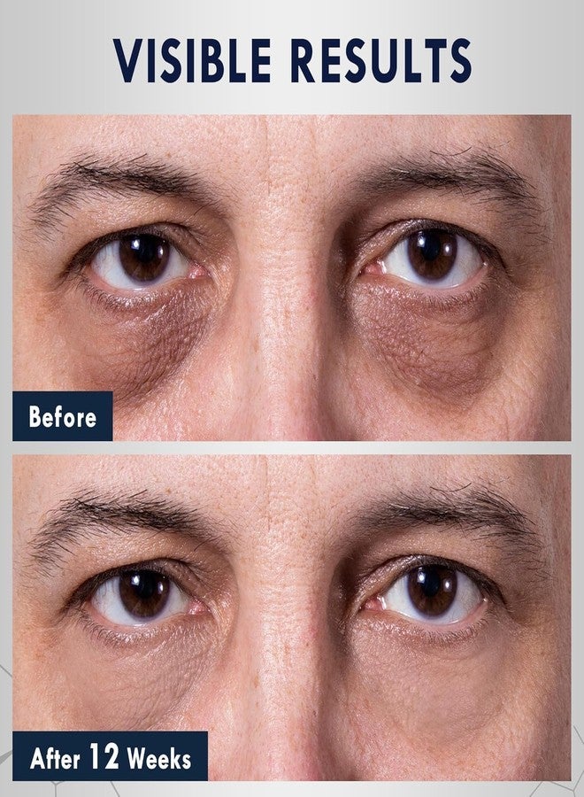 Oxbraver Eye Bags Treatment for Men, Caffeine Eye Serum for Men with Cooling Roller, Mens Eye Cream for Dark Circles and Puffiness - Image 3