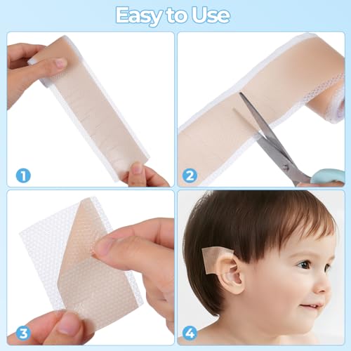Toddmomy 1 Set of Infant Ear Correction Patches: Newborn Baby Ear Aesthetic Correctors for Kids,Babies - Image 5