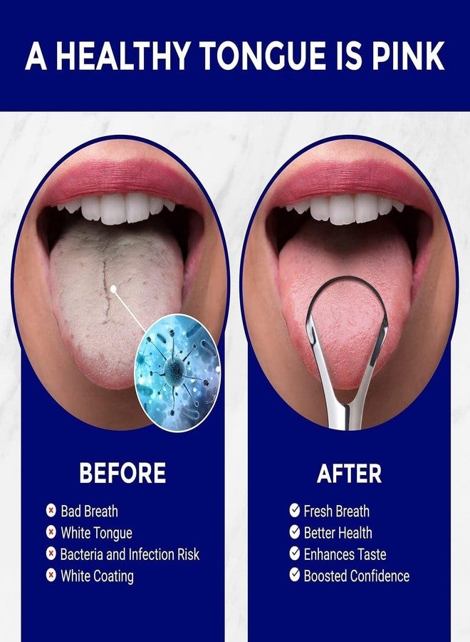 Kliffoo 1pcs Tongue Cleaner for Kids & Adults, Stainless Steel Tongue Scraper with Case for Bad Breath & Bacteria Removal, Taste Sense & Oral Health Care, Easy to Use, Silver (1Pcs Tongue Cleaner Steel - Image 2