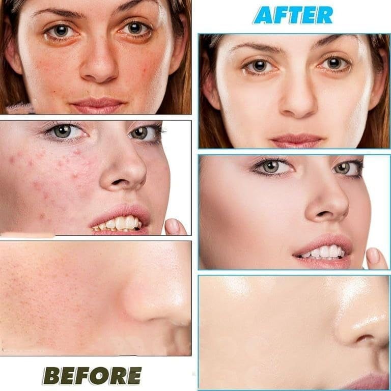 Turmeric & Kojic Acid Face Cleansing Pads for Dark Spots, Skin Brightening & Acne Prevention | Vitamin C, Retinol & Chamomile Hydrolat | For Women & Men | All Skin Type -60PCS (60 Cleansing Pads) - Image 3