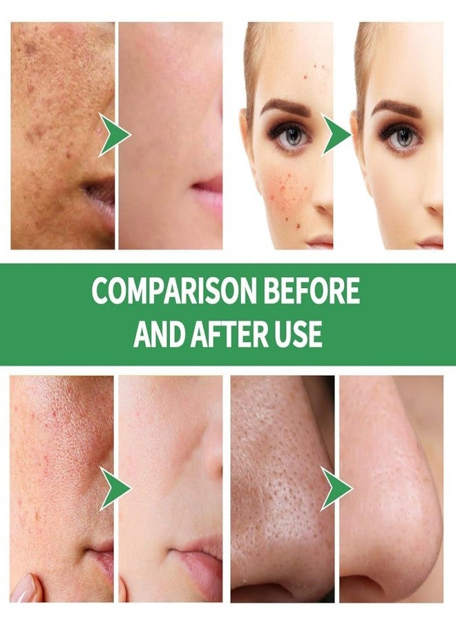 AUREUS Avocado Face Mask Avocado Centella Foam Bubble Facial Mask for Deep Cleansing Face Pack, Remove Dark Circles, Pore Minimizer, Pimples Blackhead Remover Foam Mask for All Skin Type 12PCS - Image 4