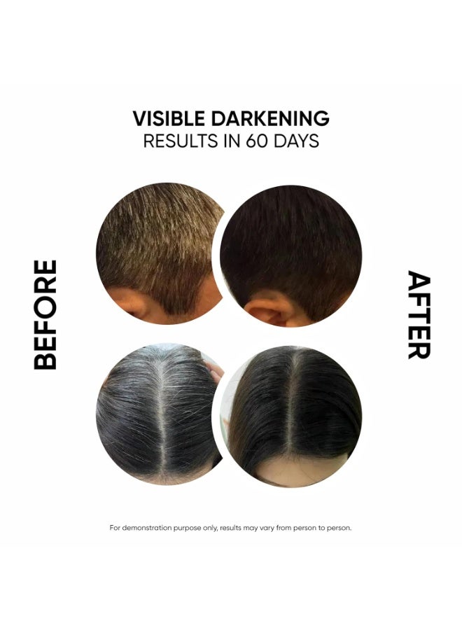Masofta Anti Grey Hair Darkening Serum for Reversing & Limiting Hair & Beard Greying With Arcolys & Melano Gray - Suitable For Men & Women, 30ML - Image 3