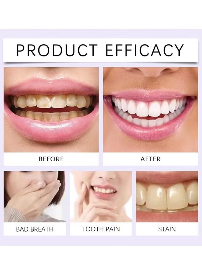 IVISMILE Purple Instant Whitening Strips, V34 Teeth Whitening Strips, Purple Tooth Whitening, Tooth Stain Treatment, Gum Care&Stain Removal, Removes Yellow Stains&Bad Breath, Combining Whitening And Colour Correction 14 Treatments - Image 2