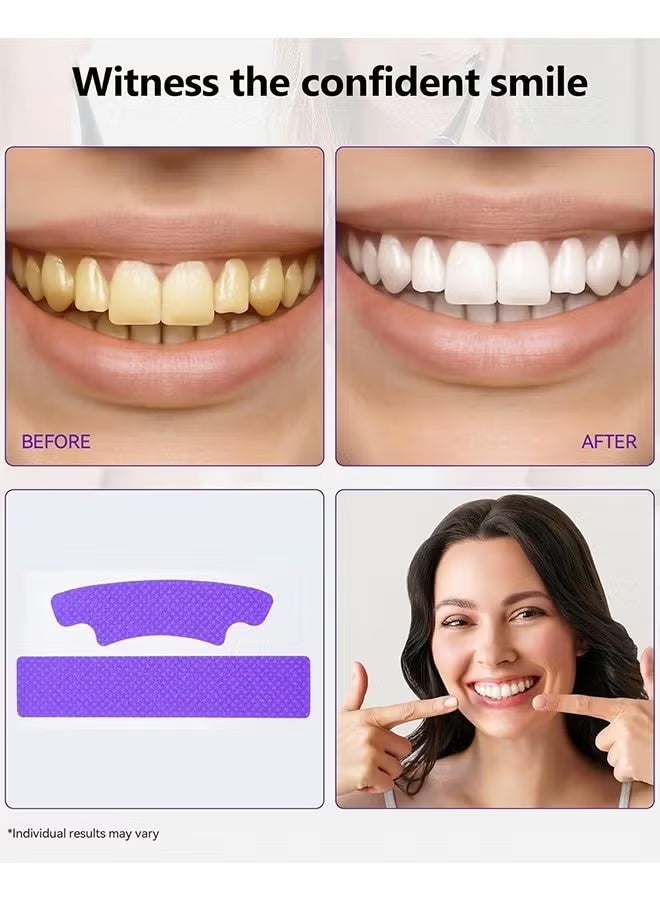 IVISMILE Purple Instant Whitening Strips, V34 Teeth Whitening Strips, Purple Tooth Whitening, Tooth Stain Treatment, Gum Care&Stain Removal, Removes Yellow Stains&Bad Breath, Combining Whitening And Colour Correction 14 Treatments - Image 4