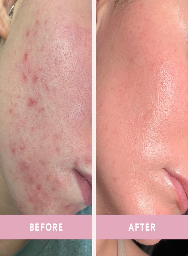 Doll 10 - Smooth Assist Overnight Facial 11% Triple-Acid Resurfacing Serum - Proven Overnight Transformation - Improves Skin Tone, Pores, Wrinkles & More - Vegan, Cruelty Free & No Parabens (1 oz - Image 3